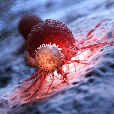 Nanoparticle-using Hyperthermia Treatment Is a Potential Substitute for Chemotherapy and Radiotherapy