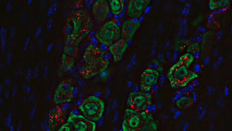 Nasal Drops Fight Brain Tumors Noninvasively