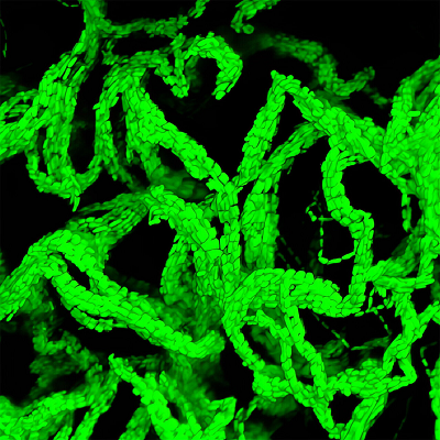 Bacteria in Polymers Form Cables That Grow into Living Gels