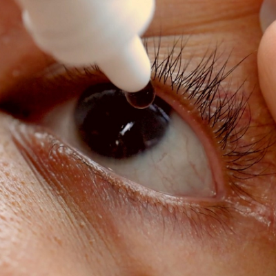 Eyes That Photosynthesise: NUS CDE Scientists Plant a Cure for Dry Eye Disease