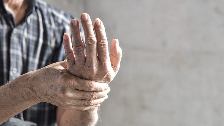 Nanoparticles for Rheumatoid Arthritis Prevention, Flare Control