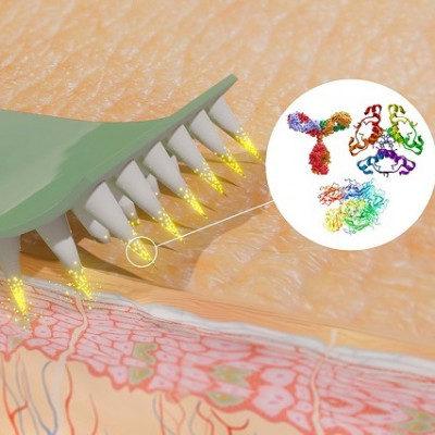 HKUMed Invents a Novel Microneedle Array Embedded with Ultrasound-triggered Antibacterial Nanoparticles Enabling a Breakthrough Treatment for Skin Infection