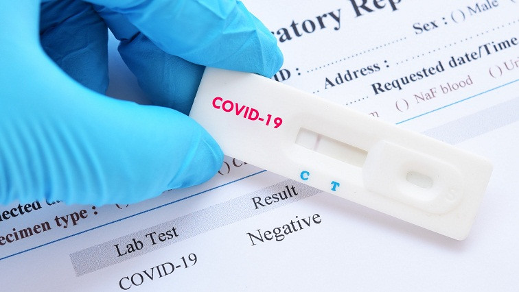 Europe’s Healthcare System Now Armed with 15-minute Coronavirus Test