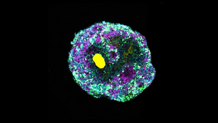 New Molecular Engineering Technique Allows for Complex Organoids