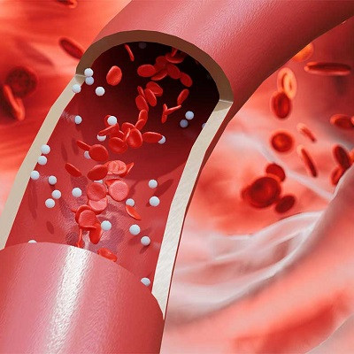 Targeted Nanomedicine Reduces Vascular Lesions, Could Help Prevent Stenosis