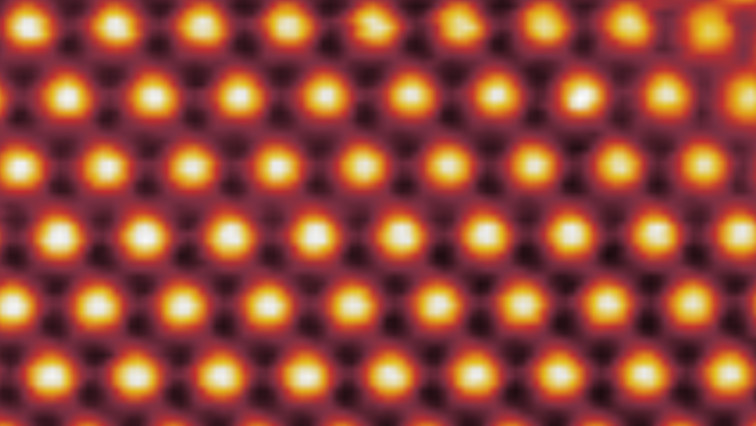 Unusual Superconductivity Observed in Twisted Trilayer Graphene