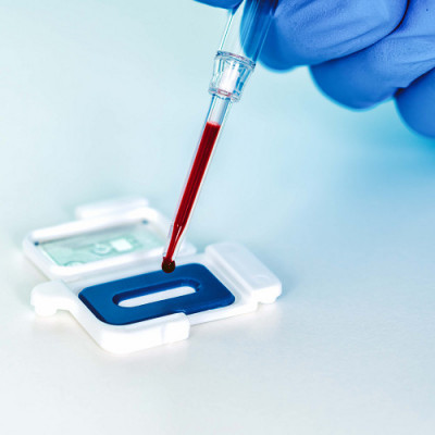 Abionic Receives IVDR Certification for Its Predictive Ultra-rapid Sepsis Test Allowing the Management of Antibiotic Administration