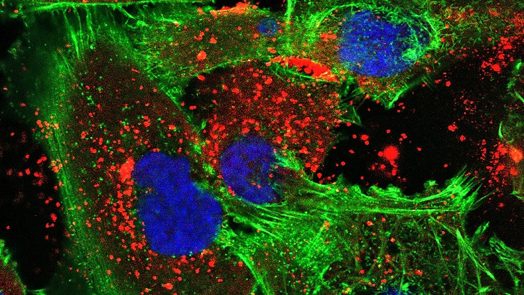 New Treatment Merges Two Technologies to Fight Brain Cancer