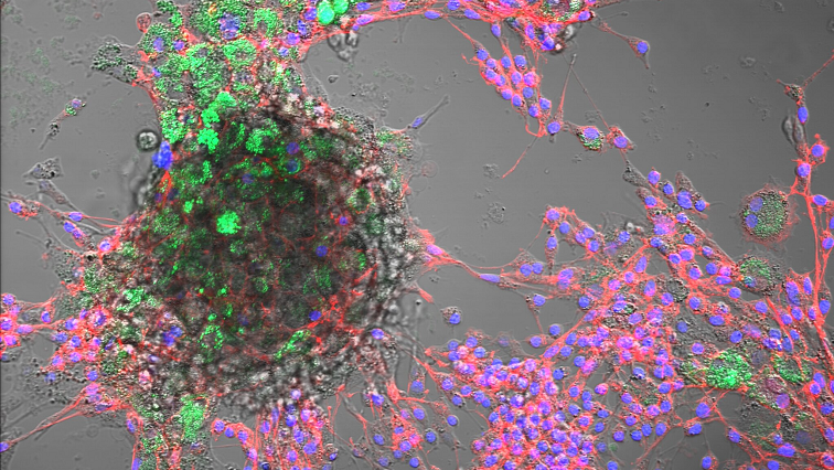 Nanoplastics Detected in Animal Cells – FBN Study Warns of Possible Consequences