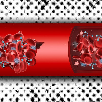 Two-component System Could Offer a New Way to Halt Internal Bleeding