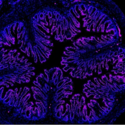 Microbiome and Nanoparticle Discoveries Hold Promise for Treating Gut Pain