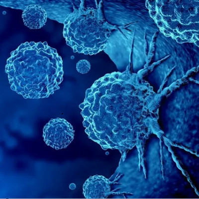 Novel Nanoparticles Deliver Innovative Cancer Chemoimmunotherapy