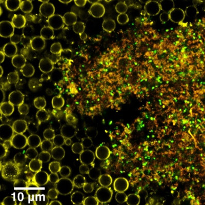 New Ultrasound Drug Delivery System Found To Be Highly Effective Against Bacterial Biofilms