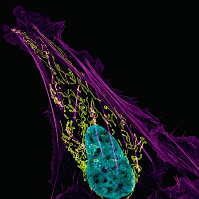 Light-induced Gene Therapy Disables Cancer Cells’ Energy Center