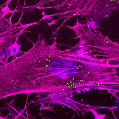 Recharging the Powerhouse of the Cell