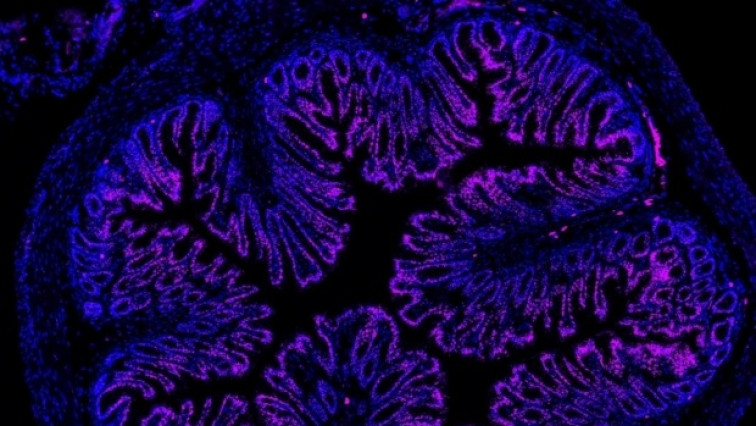 Microbiome and Nanoparticle Discoveries Hold Promise for Treating Gut Pain