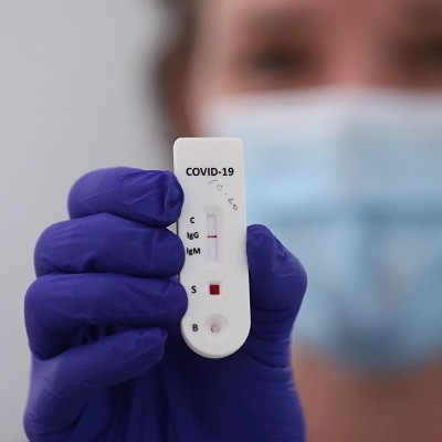 New Rapid Test to Detect Coronavirus Antibodies Developed