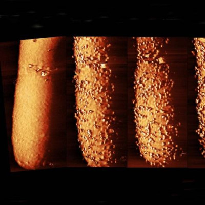 Startling Images Show How Antibiotic Pierces Bacteria’s Armour