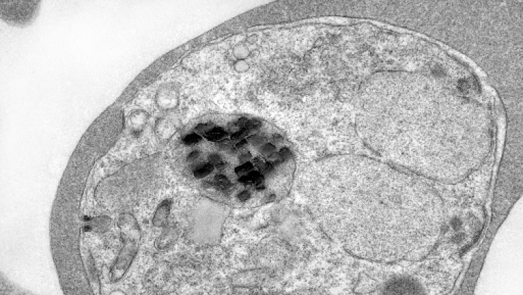 Malaria Parasites are Full of Wildly Spinning Iron Crystals. Scientists Finally Know Why.