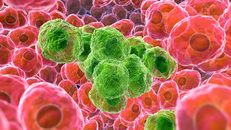 UK Innovators Target Nanoparticles at Inoperable Cancers