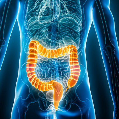 Oral Lipid Nanoparticle Drug Can Prevent Development of Colitis ...