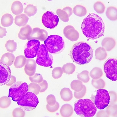 New Ultra-Long Circulating Nanoparticle Developed for Chronic Myeloid Leukemia
