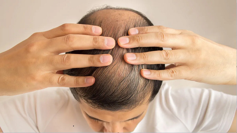 AI Helps Researchers Design Microneedle Patches That Restore Hair in Balding Mice