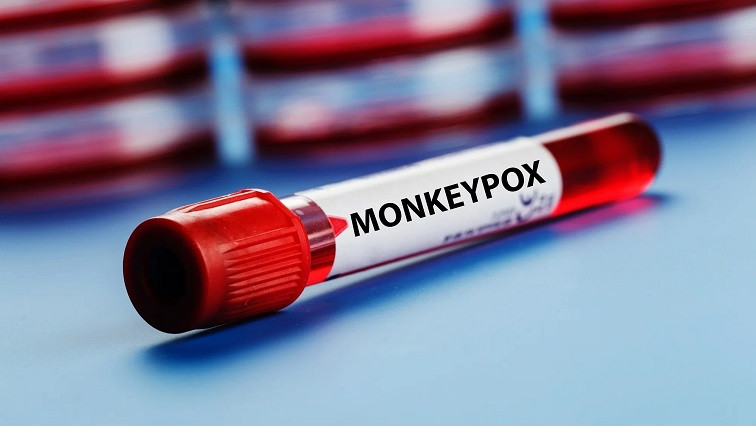 First Rapid Test for Mpox Developed, Tech Adaptable for Other Emerging Diseases