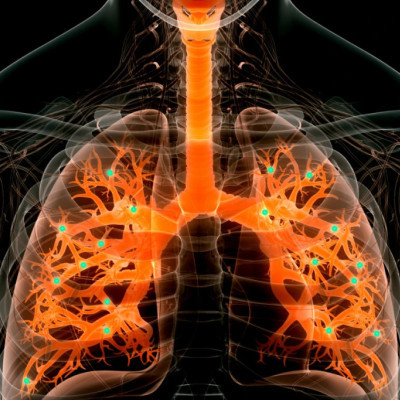 Nanoparticles Target Lung Disease