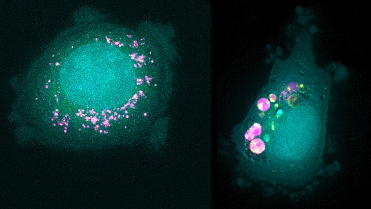 How Different Cancer Cells Respond to Drug-delivering Nanoparticles
