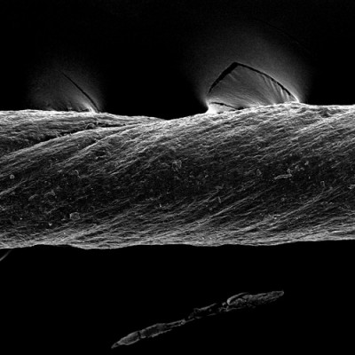 Engineers Design Sutures that Can Deliver Drugs or Sense Inflammation