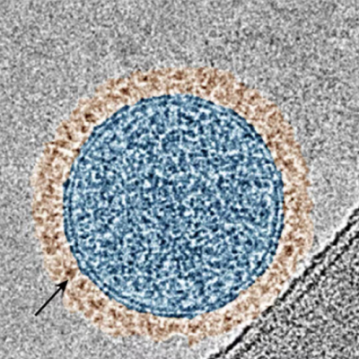 Inhalable Therapy Aims for One-Two Punch Against Advanced Melanoma