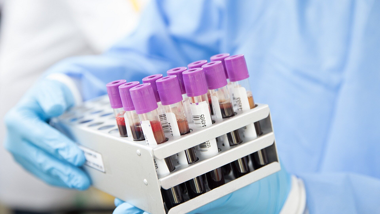 Breakthrough in Blood Test for Alzheimer’s by University of York Researchers