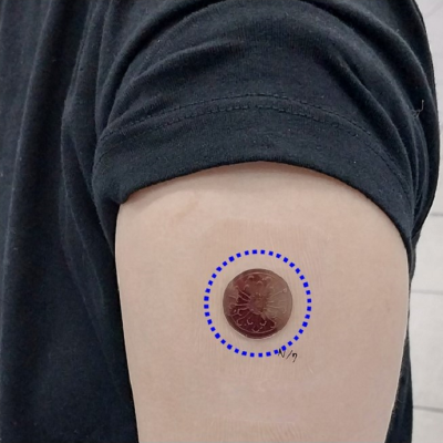 KAIST Develops Smart Patch That Can Run Tests Using Sweat Instead of Blood​