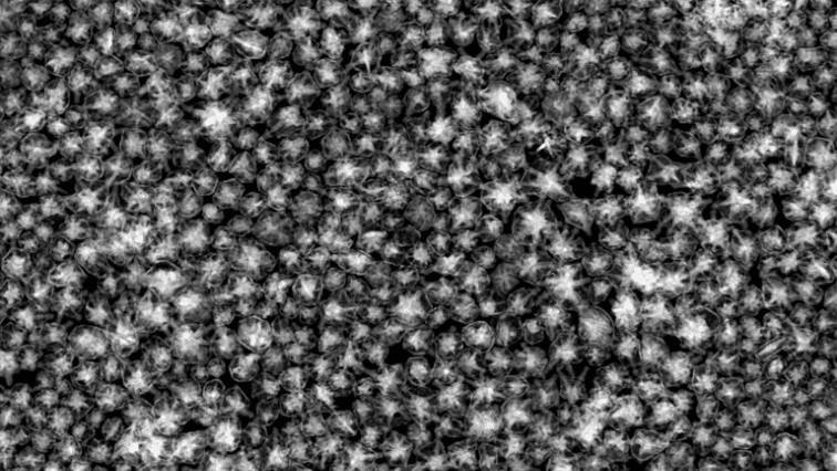 Light-and-sound-based Thermometer Helps Gold Nanoparticles Destroy Cancer