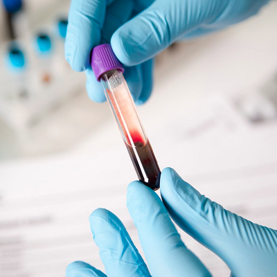 Blood Test Could Make Cancer Treatments Safer and More Effective