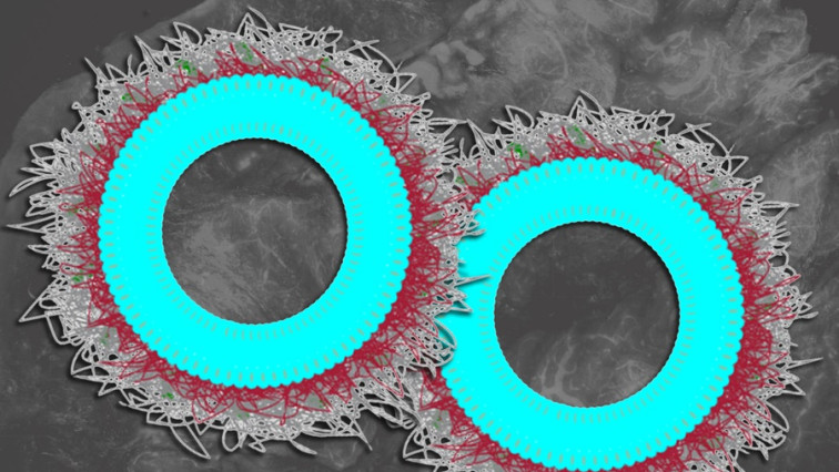 New Nanoparticles Stimulate the Immune System to Attack Ovarian Tumors