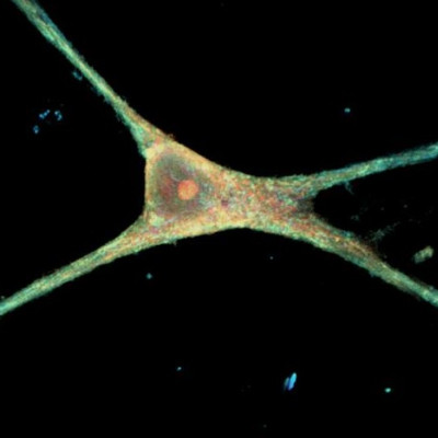 Nanowire Breakthrough Reveals Brain's Unsung Heroes in Their Natural Habitat