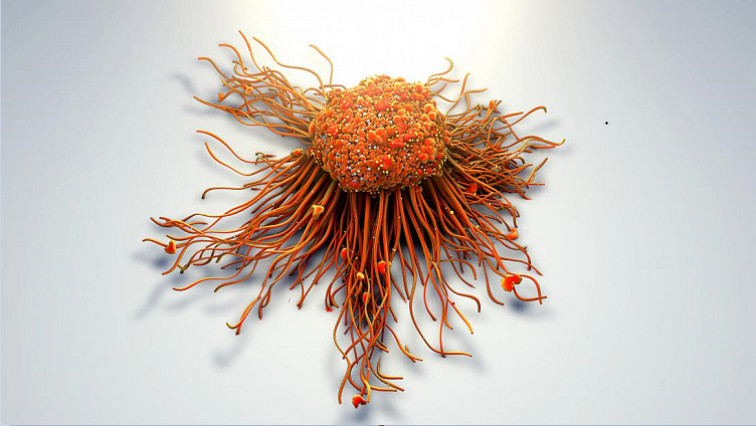 Nanotechnology Used to Destroy and Prevent Relapse of Solid Tumor Cancers