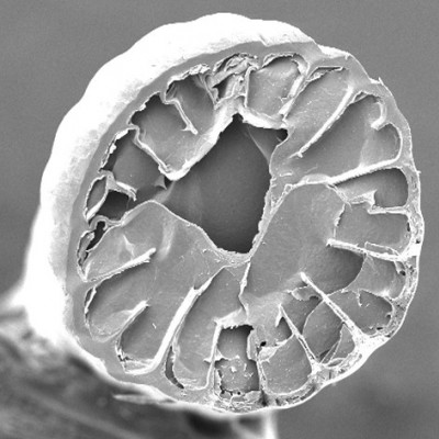 Sharp Images Show Inside a Hedgehog Spine and Reveal Citrus-like Structure