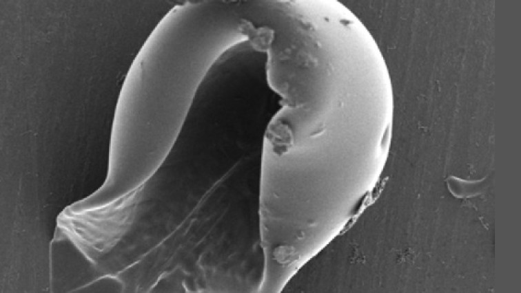 Cracking the Shell to Unlock New Frontiers in Microbiome Research