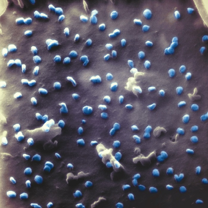 Coronaviruses (blue) exiting a kidney cell