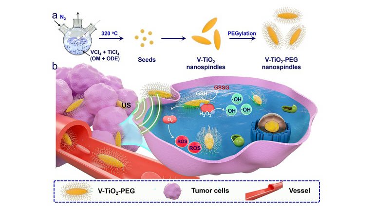 V-TiO2 nanospindles encased in polyethylene glycol (PEG) and used in combination with ultrasound waves can kill cancer cells