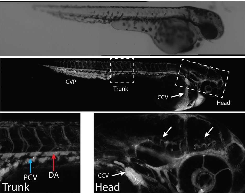 Drug delivery to the brain to treat neurodegenerative diseases