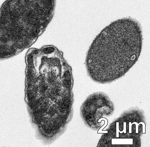 A transmission electron microscope image shows Escherichia coli bacteria in various stages of degradation