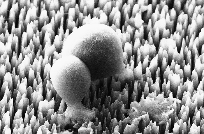 Golden staph bacteria being ruptured and destroyed by black silicon nanoneedles