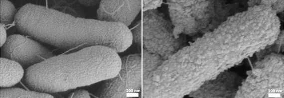 The image on the left shows an E. coli bacterial cell without protective suit