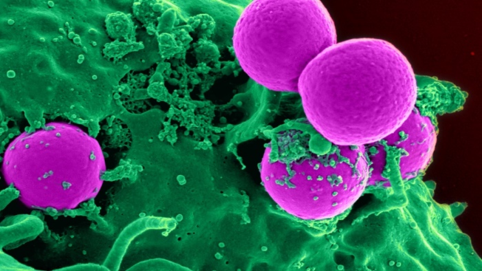 Antibiotic-resistant bacteria are being swallowed by a human white blood cell