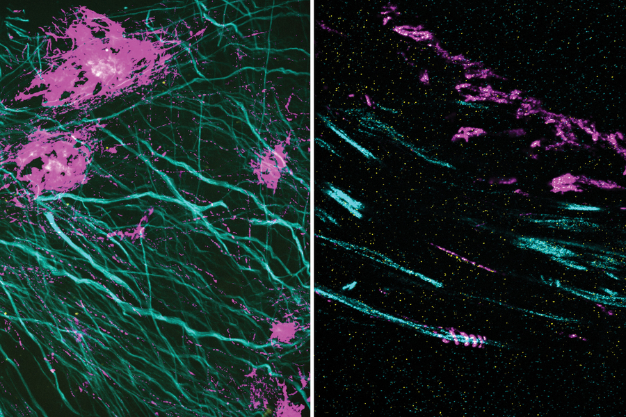 In these two images, the magenta signal is the amyloid-beta nanostructure, revealed by post-expansion staining.