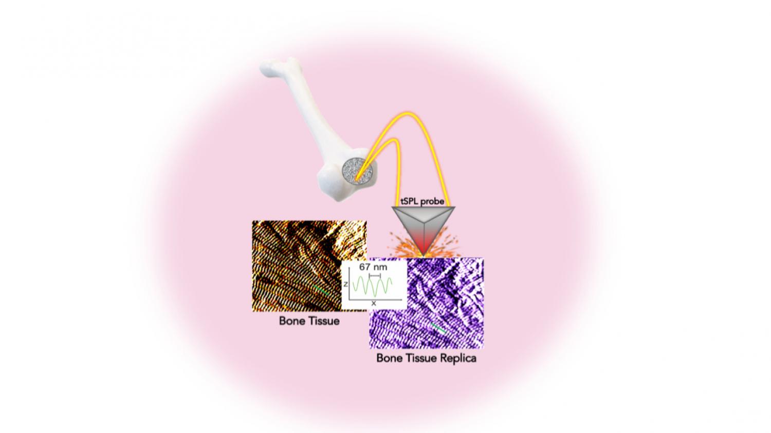 Researchers were able to replicate — with sub-15 nm resolution — bone tissue structure in a biocompatible material using thermal scanning probe lithography